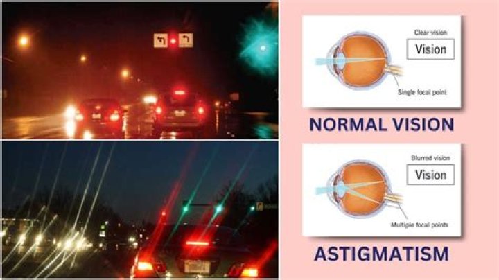 Astigmatism, Night Lights, And Rain
