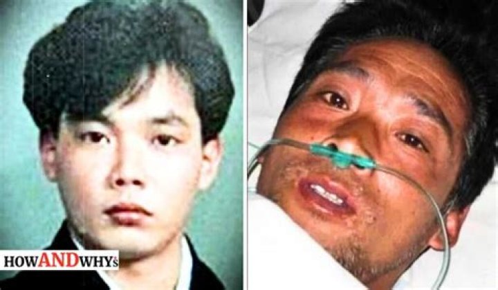 Hisashi Ouchi was kept alive for 83 days after absorbing 17 Sieverts of